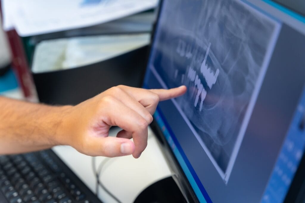 Dental clinic, dentist explaining to a client the teeth to be implanted with the computer